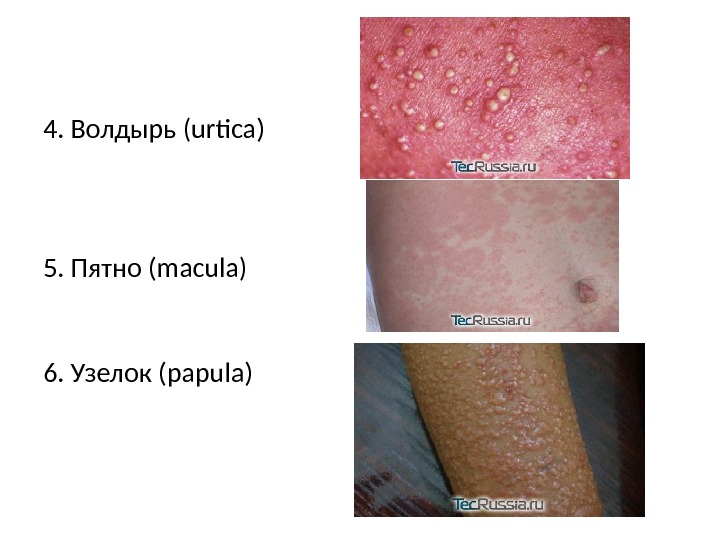 Кожные заболевания на фоне стресса