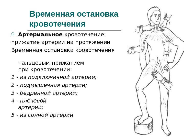 Правила остановки артериального кровотечения обж 11 класс презентация