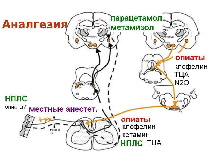 Мультимодальная анестезия презентация