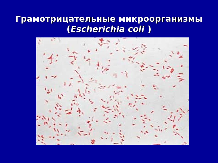 Грамположительные и грамотрицательные бактерии таблица. Грамотрицательная микрофлора. Грамотрицательная микрофлора. Грамотрицательные стрептококки микроорганизмы. Fusobacterium nucleatum (палочка плаута).
