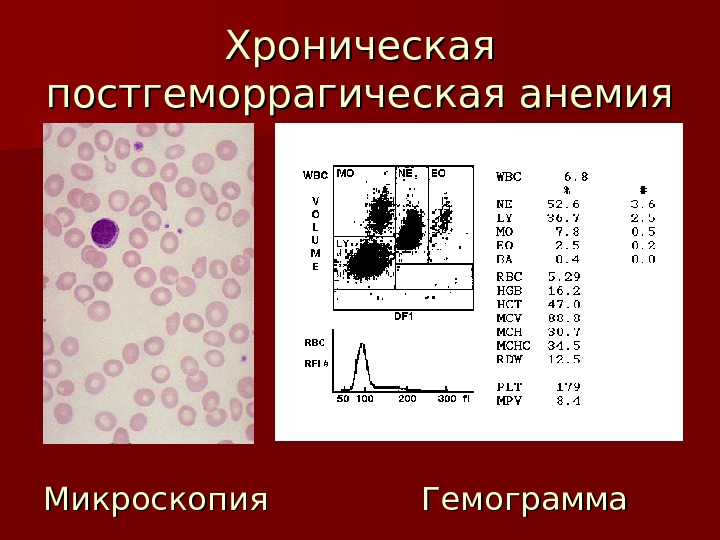 Постгеморрагическая анемия показатели