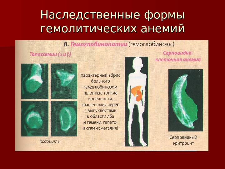 Презентация на тему гемоглобинопатия