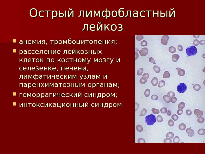 Картина крови выраженная нормохромная анемия тромбоцитопения бластов до 60 характерная для