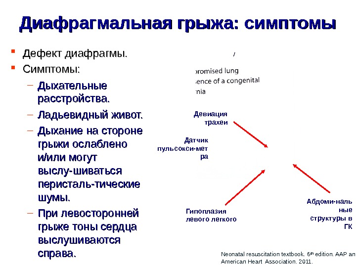 Диафрагмы симптомы. Грыжа диафрагмы симптомы. Симптомы болезней диафрагмы. Диафрагмальная грыжа симптомы. Заболевания диафрагмы симптомы.