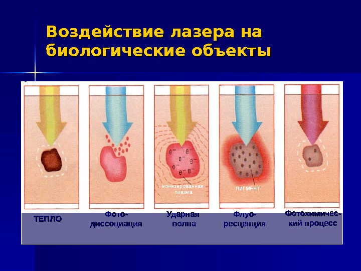 На рисунке представлены эффекты высокоинтенсивного лазерного излучения на биологические ткани где
