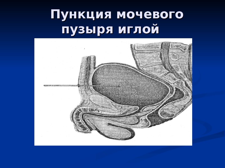 Анатомия малого таза презентация