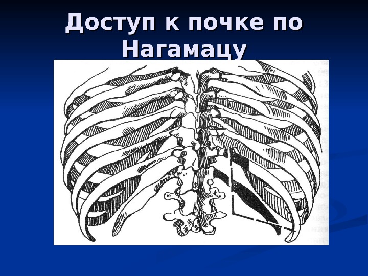 Забрюшинное пространство презентация