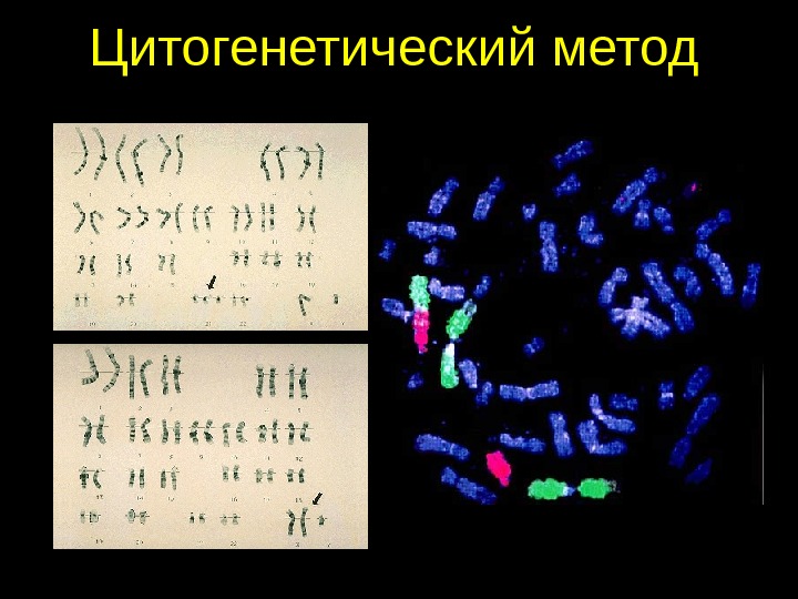 Генетическое исследование хромосом. Рисунок методики цитогенетического исследования. Цитогенетический метод генетика. Цитогенетический метод исследования генетика. Цитогенетика человека методы.