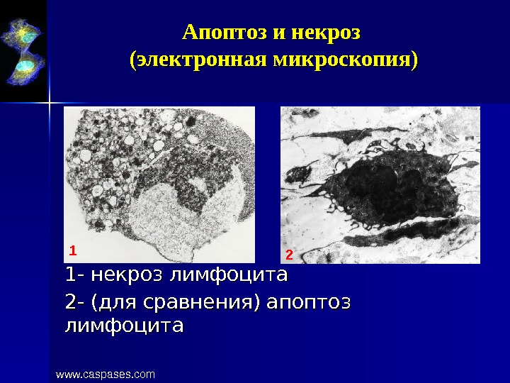 Презентация на тему некроз апоптоз