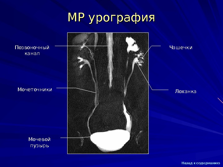 Mrt mac os грузит процессор