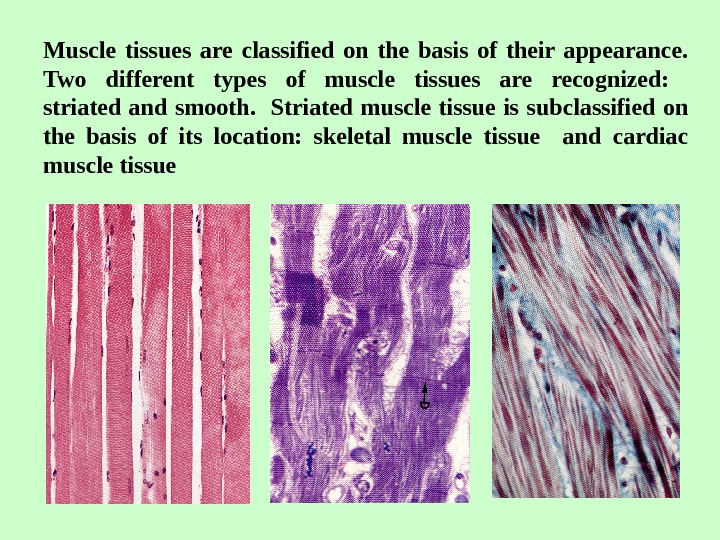 Muscular tissue. Striated muscle Tissue. Types of muscle Tissue. 1. What are the Types of muscle Tissue?. There are two Types of the muscle Tissue - smooth and.