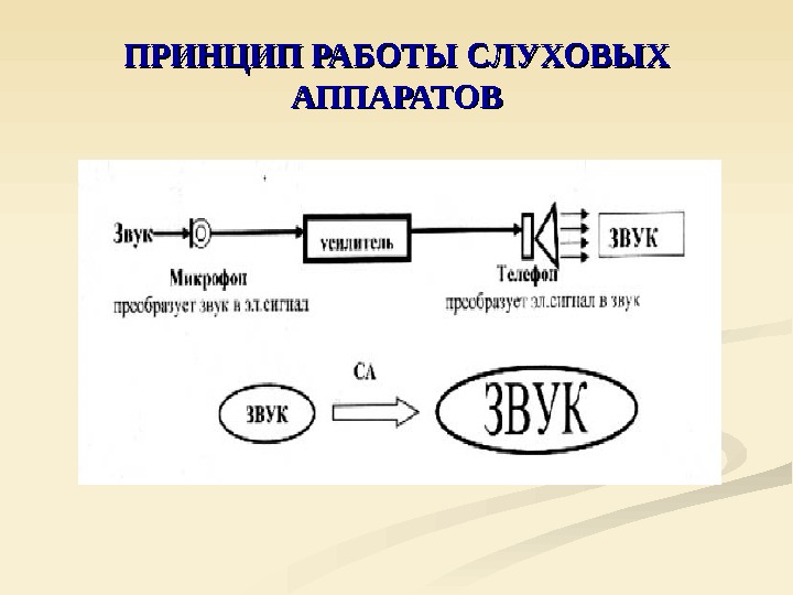 Структурная схема слухового аппарата