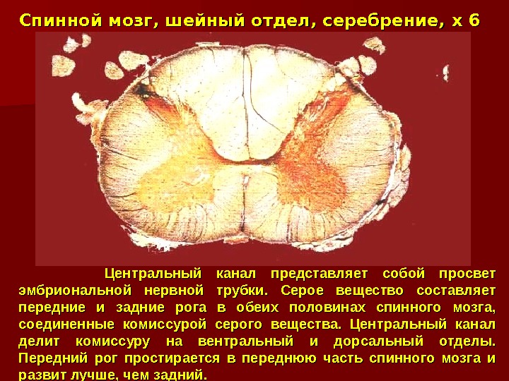 Центральный спинной мозг. Центральный канал спинного мозга функции. Центральный канал спинной мозг. Центральный спинномозговой канал выстлан. Центральный спинномозговой канал заполнен.