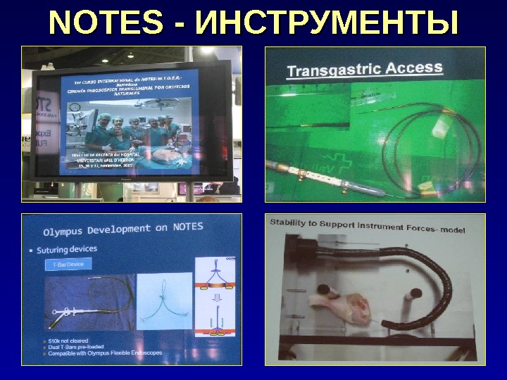 Транслюминальная хирургия презентация