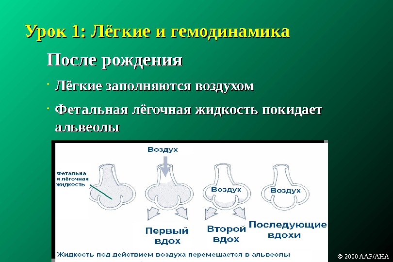 Легкие заполнены жидкостью. Механизм первого вдоха новорожденного. Схема первого вдоха новорожденного. Механизм первого вдоха новорожденного схема. Механизм первого вдоха новорожденного физиология.