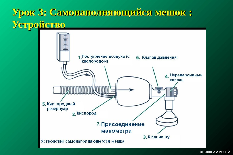 Схема ивл. Нереверсивный клапан. Нереверсивный дыхательный клапан. Клапан нереверсивный, одноразовый. Клапан нереверсивный одноразового использования.