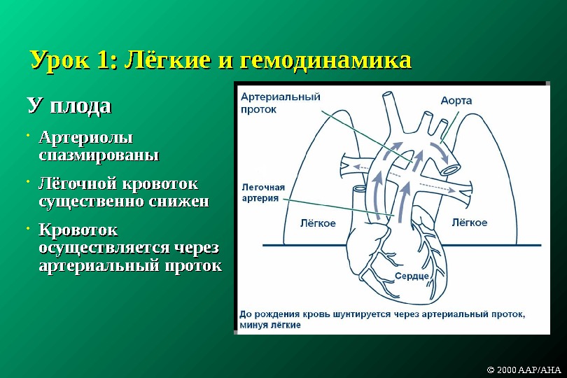 Оап у новорожденных. Открытый артериальный (боталлов) проток. Открытый артериальный проток схема. Боталлов проток (артериальный проток).