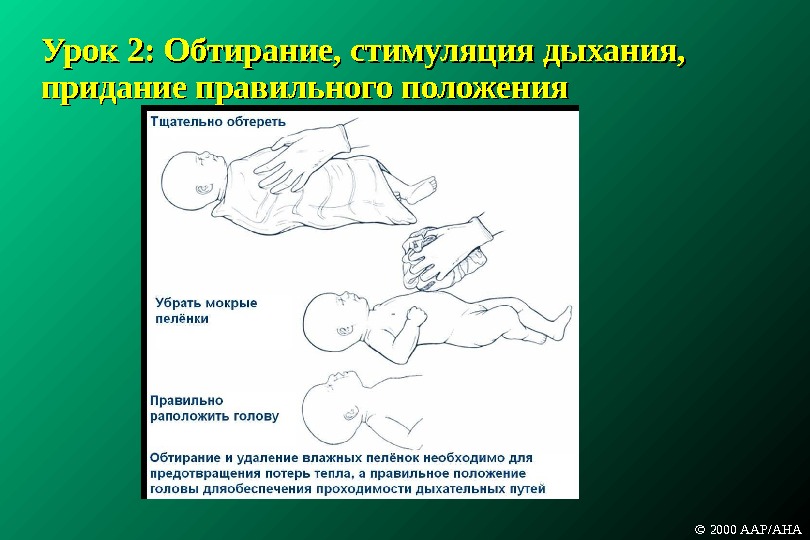 Реанимация новорожденного презентация