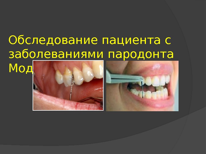 Обследование пародонта. Обследование пациентов с заболеваниями пародонта. Обследование больного с заболеваниями пародонта. Методы обследования пародонта. Обследование пациента с патологией пародонта.