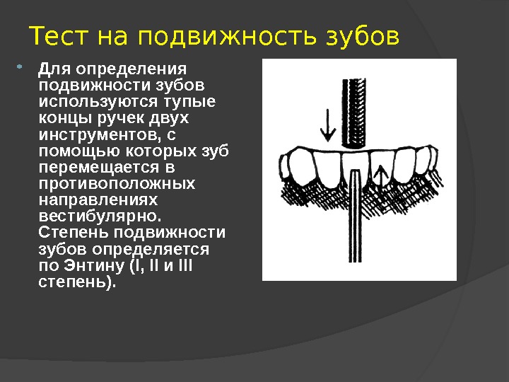 Подвижность зубов презентация