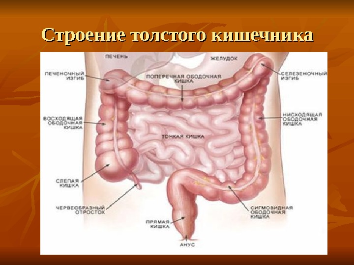 Презентация Опухоли кишечника