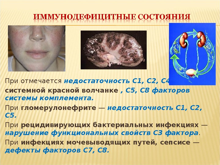 Презентация Первичные и вторичные иммунодефицитные состояния