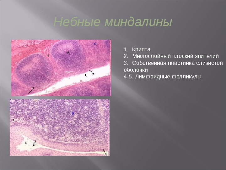 Небная миндалина гистология рисунок