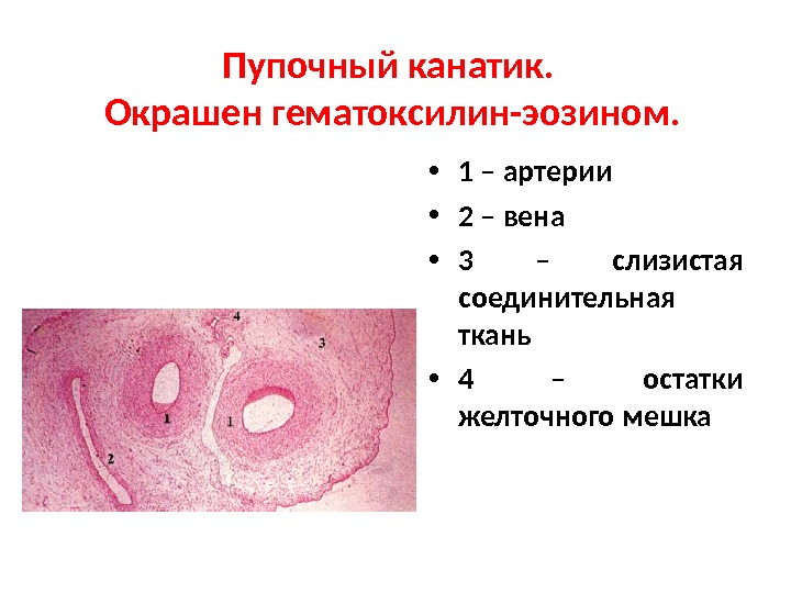 Слизистая ткань. Пупочный канатик гистология препарат. Пуповина человека препарат гистология. Пуповина строение гистология. Пуповина поперечный срез препарат.