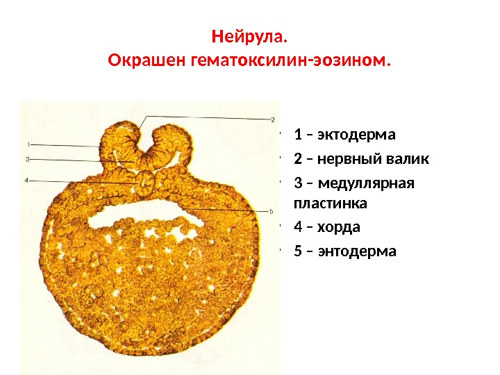 Рисунок нейрулы с подписями