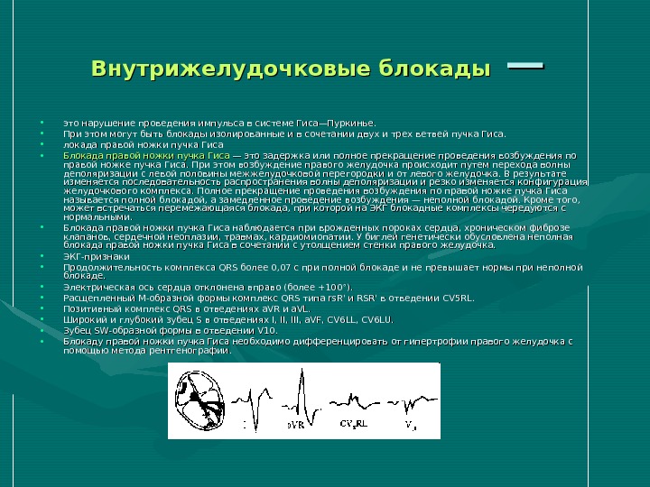 Нарушение проведения. Нарушение внутрижелудочковой проводимости. Внутрижелудочковые блокады. Внутрижелудочковые блоки. • Внутрижелудочковые блокады (блокады ветвей пучка Гиса).