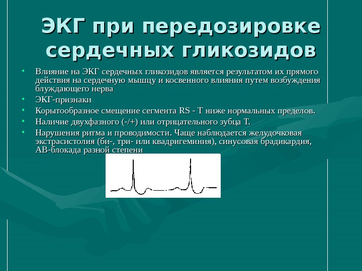 При передозировке сердечных гликозидов применяют. ЭКГ при сердечных гликозидах. ЭКГ при передозировке. Передозировка сердечными гликозидами симптомы. Изменения на ЭКГ при передозировке сердечными гликозидами.