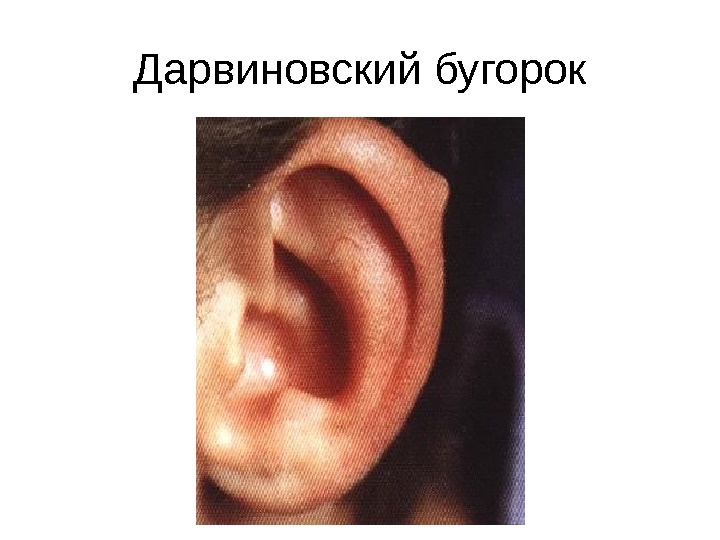 Презентация презентация лекций — Лекция 1 — наружный и средний отит