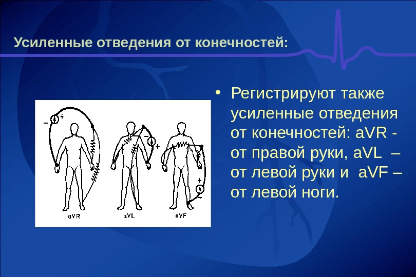 Правые отведения. Отведения от конечностей ЭКГ. Усиленные отведения ЭКГ. Усиленные однополюсные отведения от конечностей. Усиленные отведения от конечностей ЭКГ.