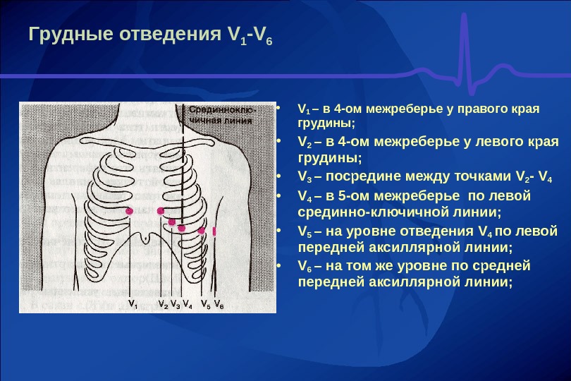 Левая половина грудной клетки. ЭКГ электроды v1-v6. Где находится межреберье. Четвертое межреберье. 5 Межреберье.