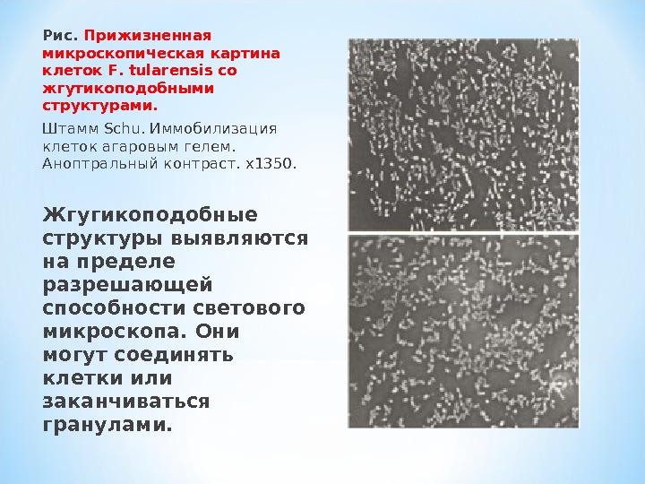 Микроскопическая картина u норма