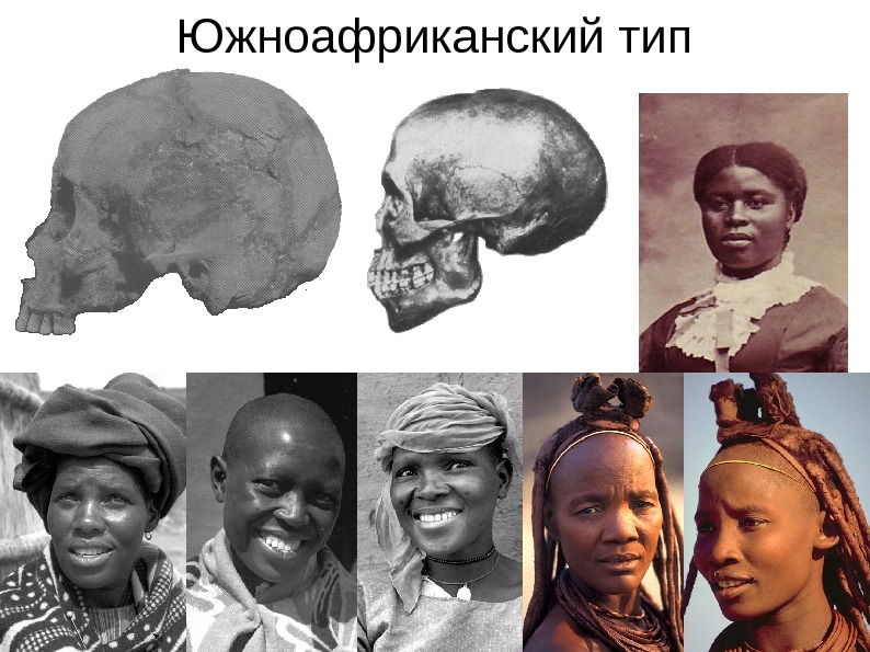Типы негроидной расы. Эфиопская раса. Негроидная Африканская раса. Негроидная раса нос. Нации негроидной расы.