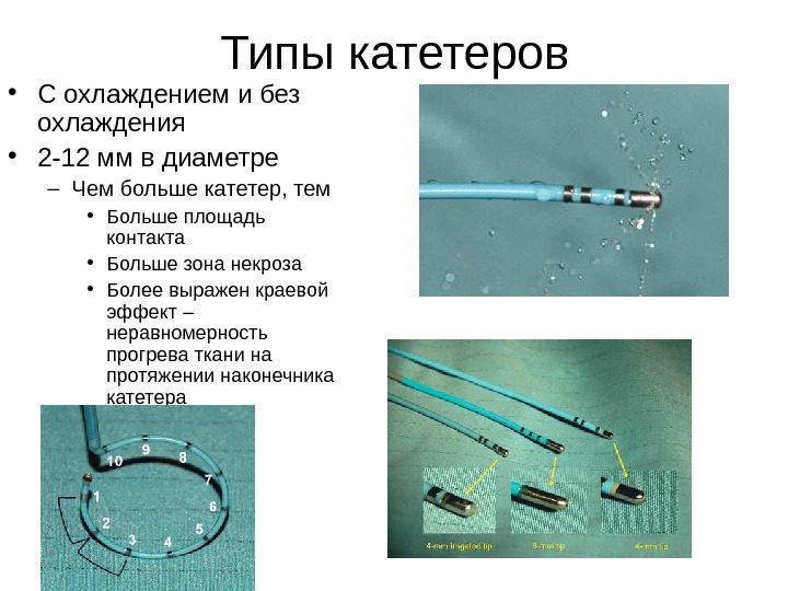 Виды катетеров схема