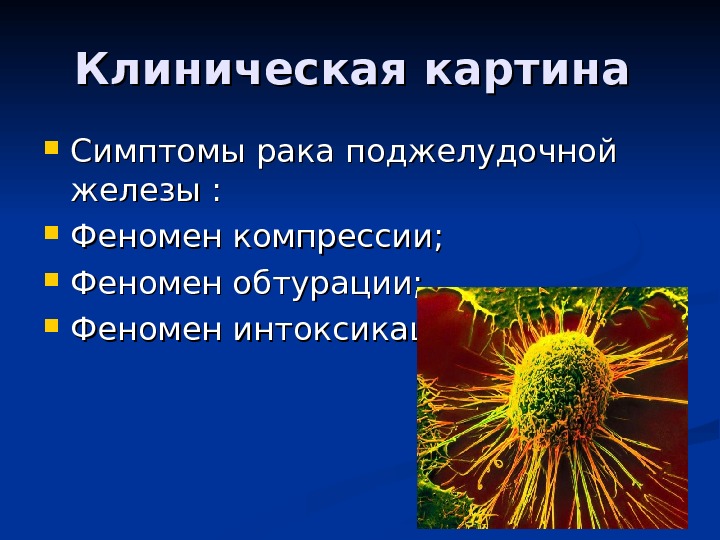 Рак поджелудочной железы презентация по онкологии