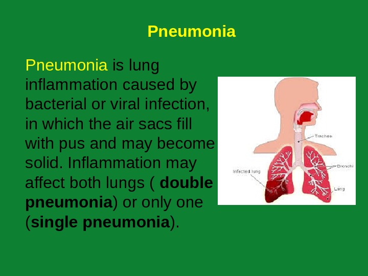 Презентация на английском пневмония