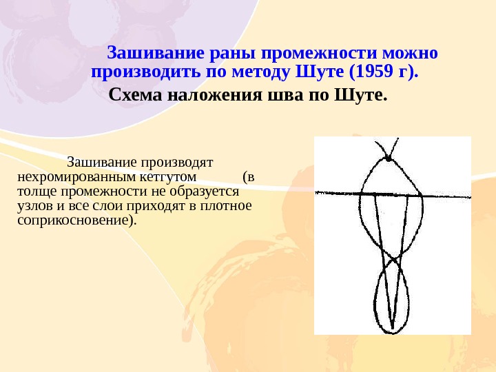 Родовой травматизм матери и плода презентации