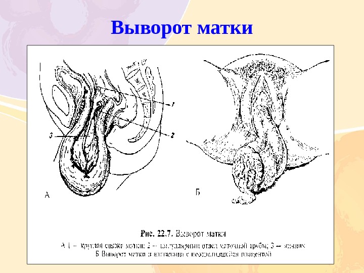 Влагалище После Родов Картинки