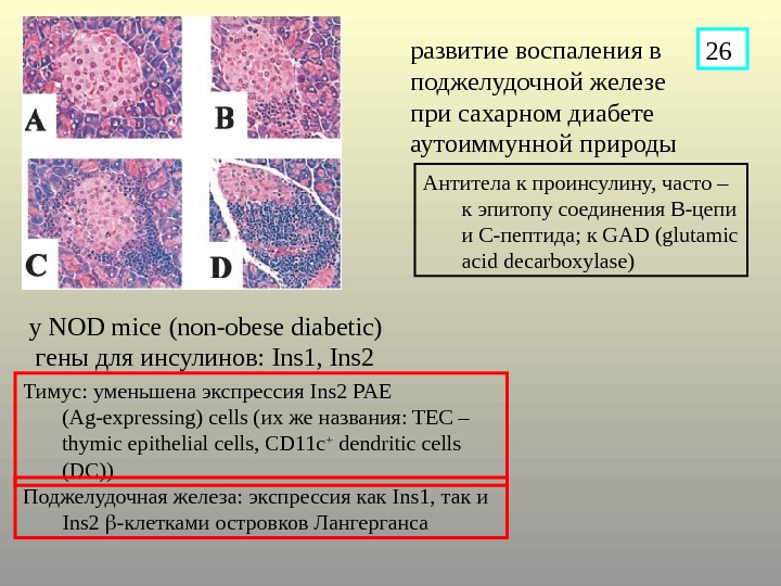 Сахарный диабет железа. Функции поджелудочной железы при сахарном диабете. Роль поджелудочной железы при сахарном диабете. Поджелудочная железа при сахарном диабете 1 типа. Поджелудочная железа при сахарном диабете 2 типа.