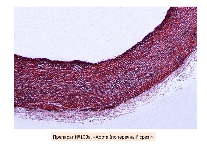 Артерия эластического типа рисунок