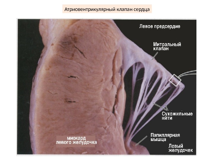 Митральный клапан гистология рисунок