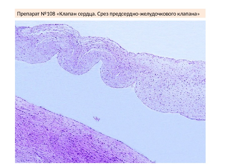 Сердце гистология презентация