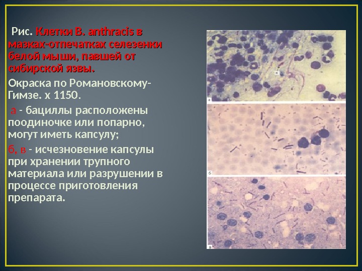 Окраска мазка по романовскому гимза. Окрашивание по Романовскому - Гимзе. Сибирская язва по Романовскому Гимзе. Риккетсии окраска по Романовскому Гимзе.