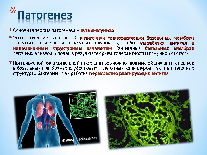 Синдром гудпасчера презентация