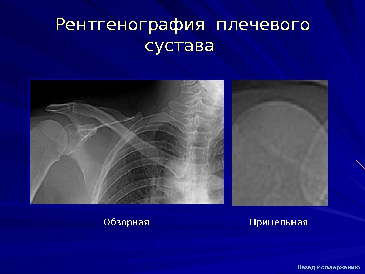 Рентгенография с прямым увеличением изображения применяется