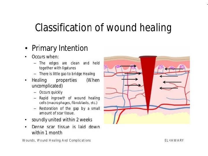 Презентация wounds. wounds healing amp complications