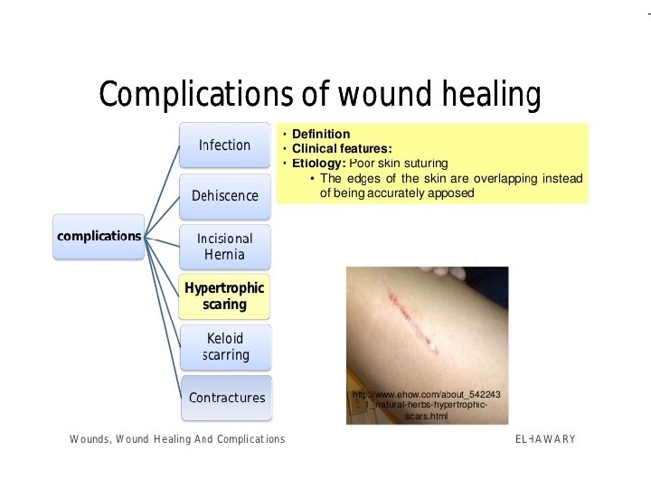 Презентация wounds. wounds healing amp complications